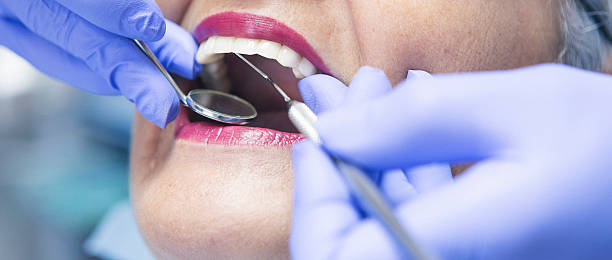Best Knocked-Out Tooth Emergency  in South Russell, OH